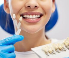 Sublimez votre sourire grâce aux facettes